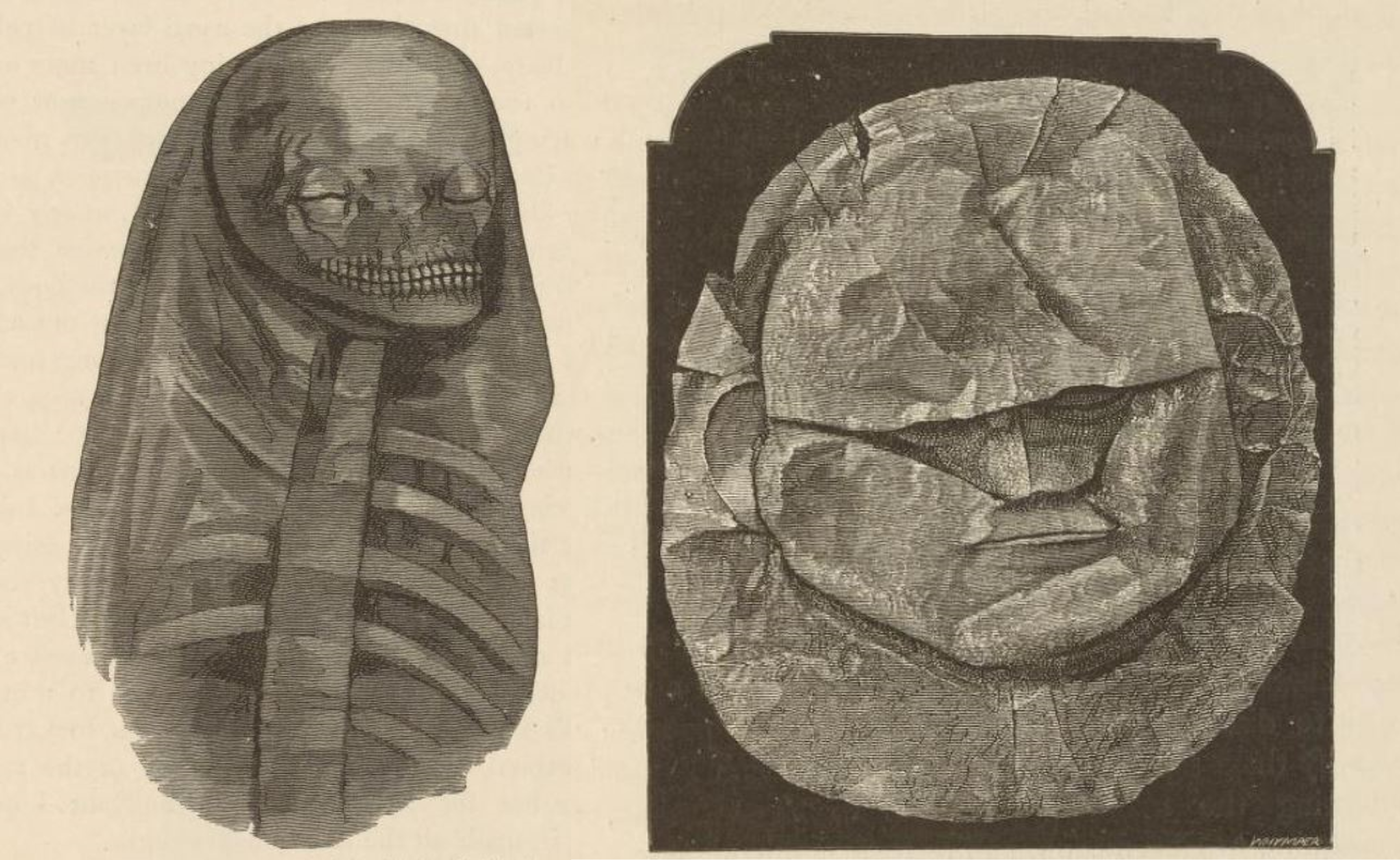 Schliemann und die mykenische Mumie